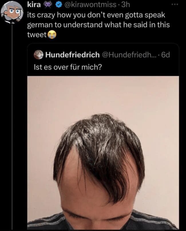 A self-deprecating classic meme tweet. A man with extremely thin, wispy hair on his crown posts a top-down photo with the caption, "Ist es over für mich?" The quote tweet notes that you don't even need to speak German to understand he’s asking if it’s "over" for his hairline.