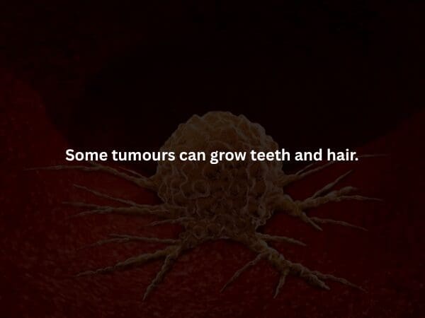 A macabre creepy fact featuring a photo of stained, primitive dentures held together by thin metal wires. It explains the historical horror that dentures were once crafted using the teeth of dead soldiers harvested from battlefields.