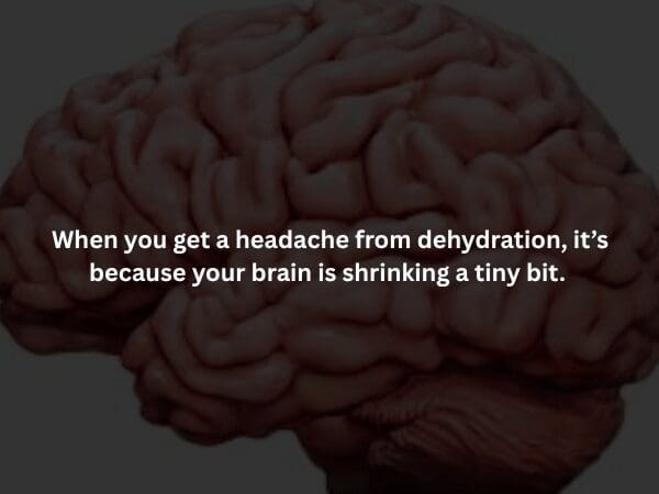 A grayscale medical illustration of a human brain against a dark background. The overlaid text explains a creepy fact about dehydration headaches: they occur because your brain is physically shrinking a tiny bit inside your skull.