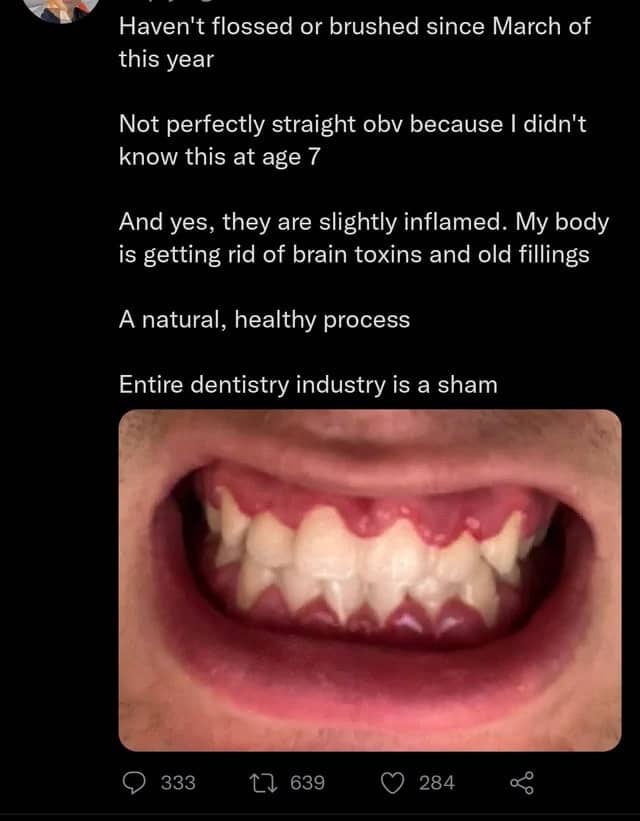 A social media post showing inflamed gums with a debunked claim that dentistry is a sham.