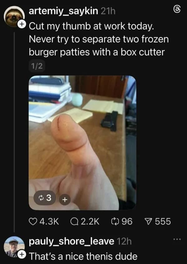 hilarious meme from a social media thread. A user posts a photo of their thumb, which they cut while trying to separate frozen burger patties. Because of the angle and the cut, the thumb looks remarkably phallic, leading a commenter to reply: "That's a nice thenis dude."