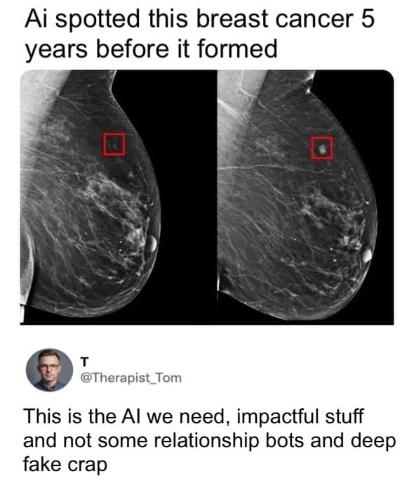 A side-by-side medical comparison showing the power of technology in this meme dump. The left panel shows an early AI detection of breast cancer five years before it fully formed (marked by a red box). A quote from @Therapist_Tom points out that this is the impactful AI the world actually needs, rather than deepfakes or relationship bots.