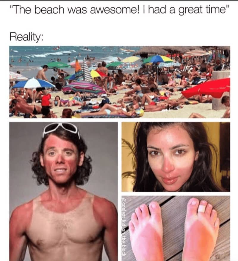 Collage of a crowded beach and people with severe, oddly-shaped sunburns.