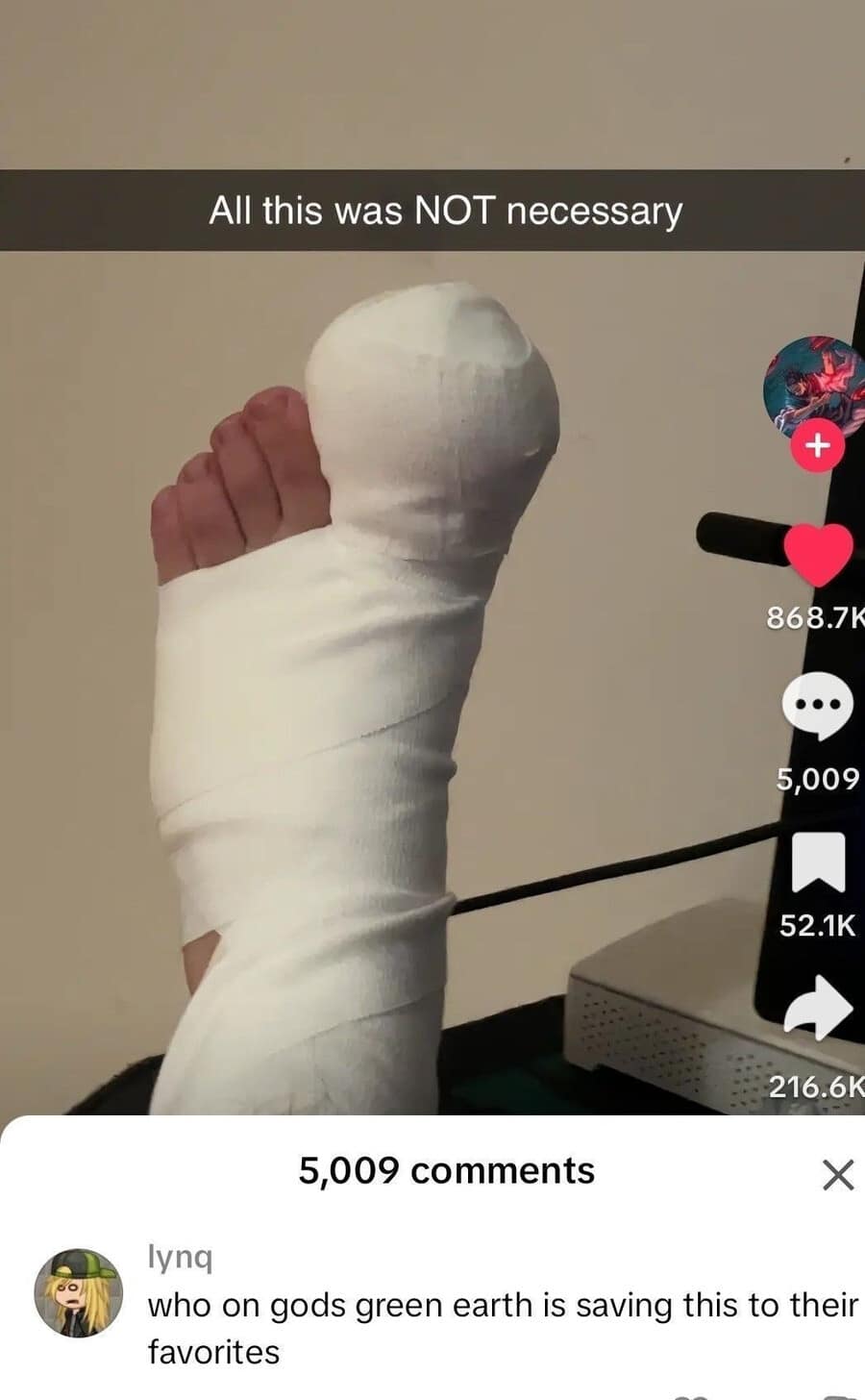 A classic meme screenshot of a mobile video post showing a foot wrapped in a heavy white medical cast that leaves only the four smallest toes completely exposed, paired with a baffled user comment asking who is saving the image to their favorites.