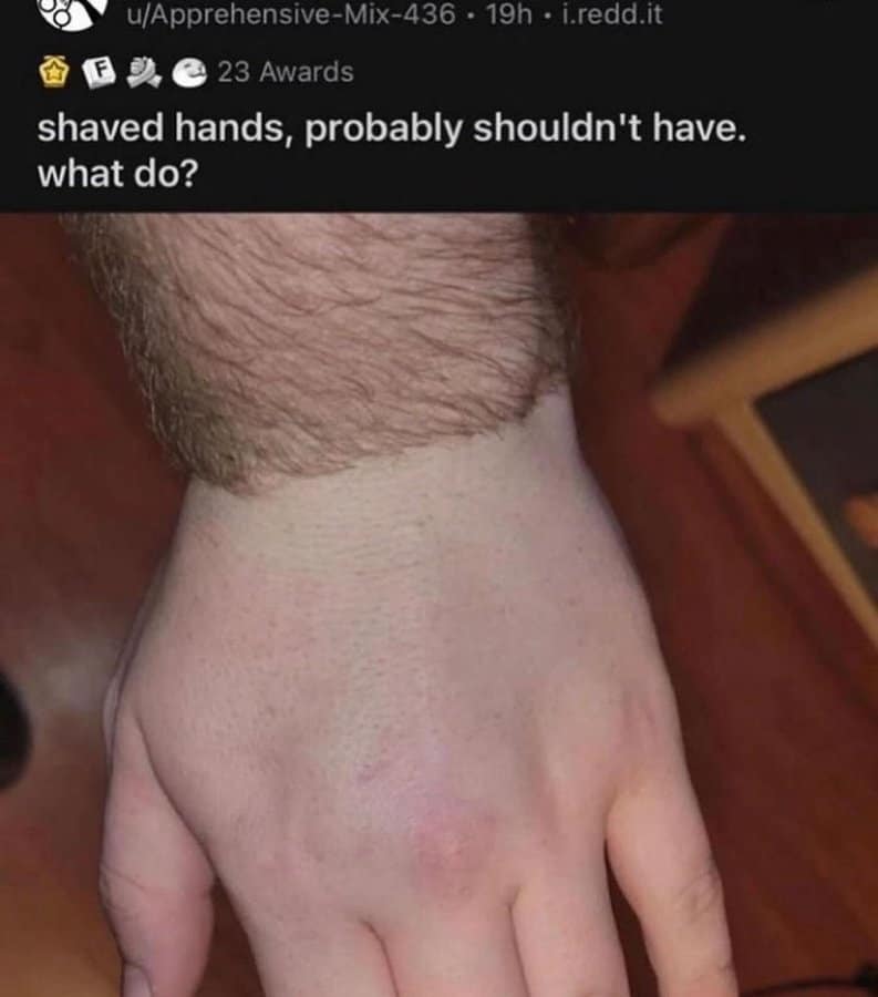 A truly cursed funniest reddit posts photo showing a man with an extremely hairy arm who has shaved his hand and wrist perfectly smooth, asking the internet "what do?"