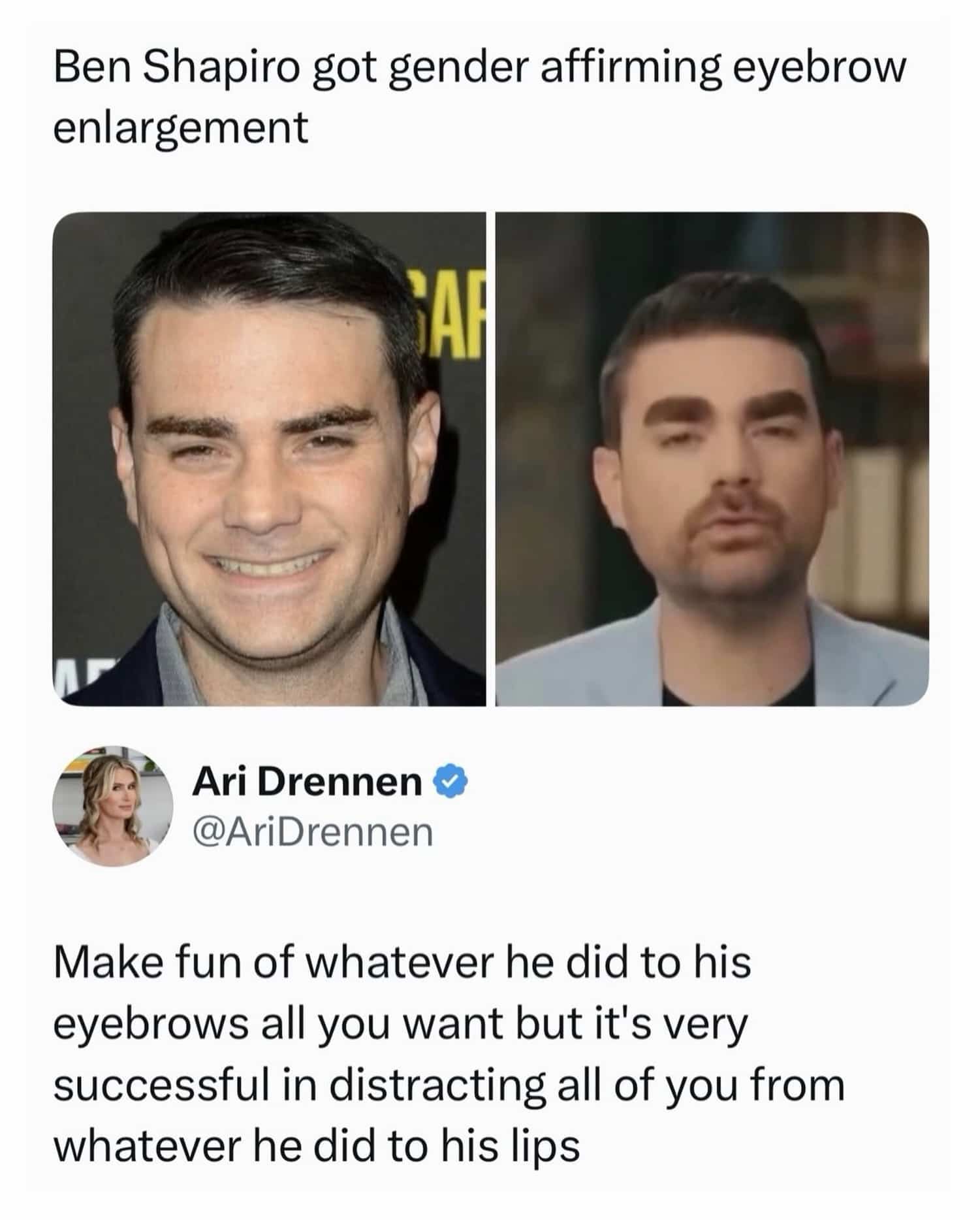 Meme side-by-side comparison of Ben Shapiro mocking his allegedly edited eyebrows and lips.