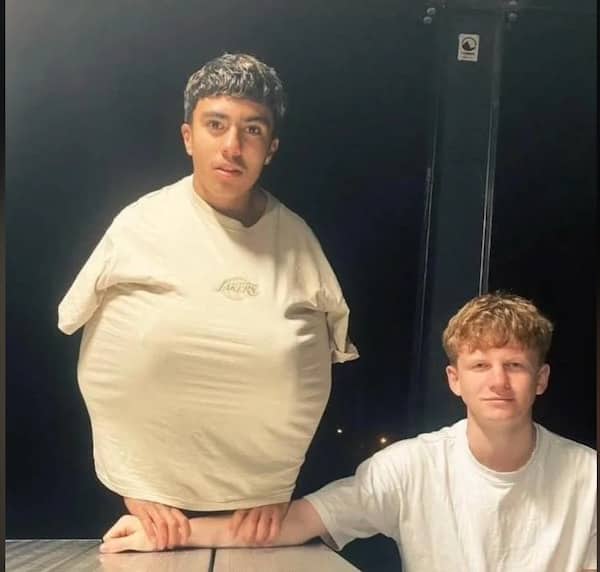 Silly optical illusion meme where a friend's arm makes a teenager look like he has a large chest.