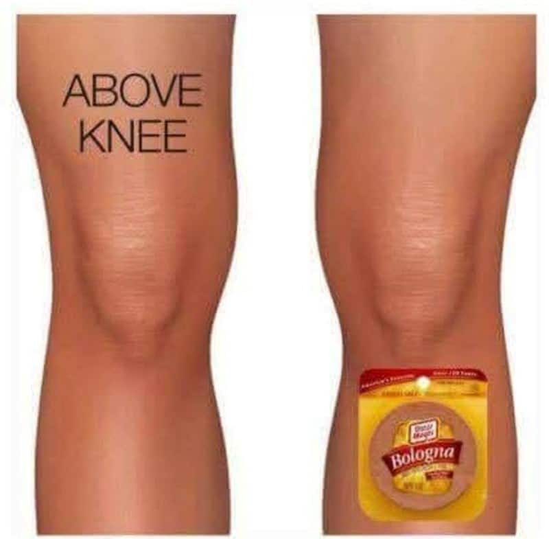 A punny meme showing two legs; the left is labeled "ABOVE KNEE" and the right has a pack of Oscar Mayer meat positioned to create the funny pun "Bologna" (Below-knee).