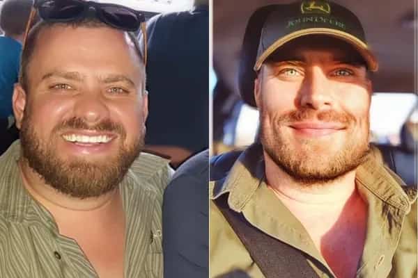 Two photos of a man showing significant facial thinning and eye color changes.