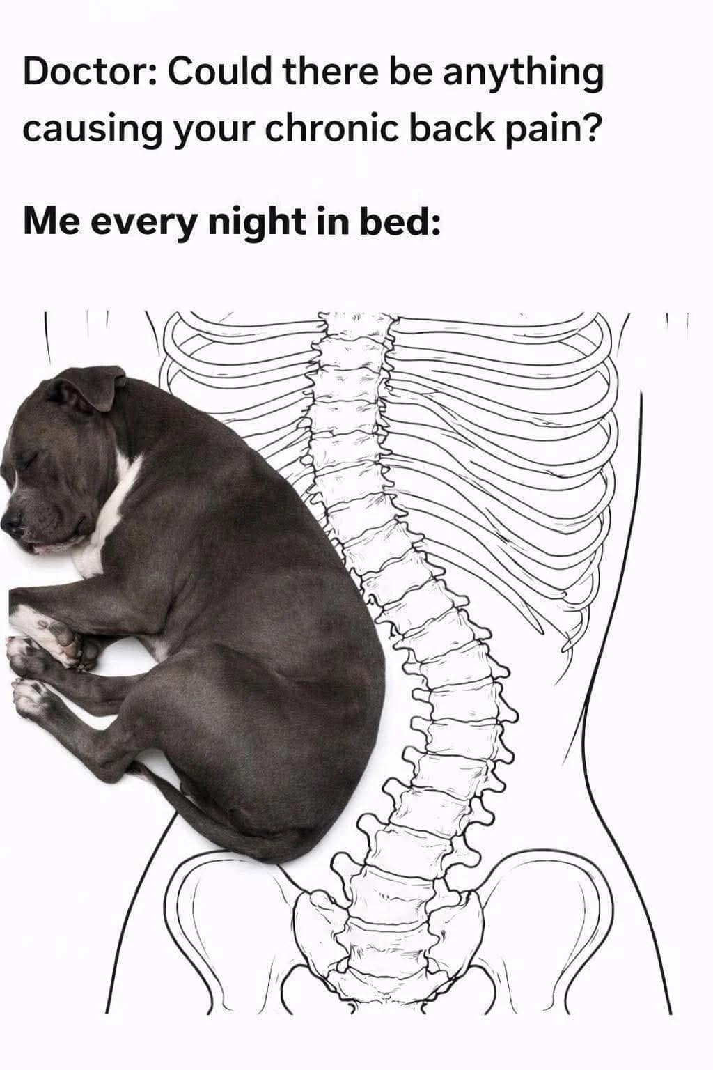 A relatable funny meme anatomical diagram showing a human spine with extreme curvature to accommodate a sleeping pitbull, explaining the mystery of chronic back pain.