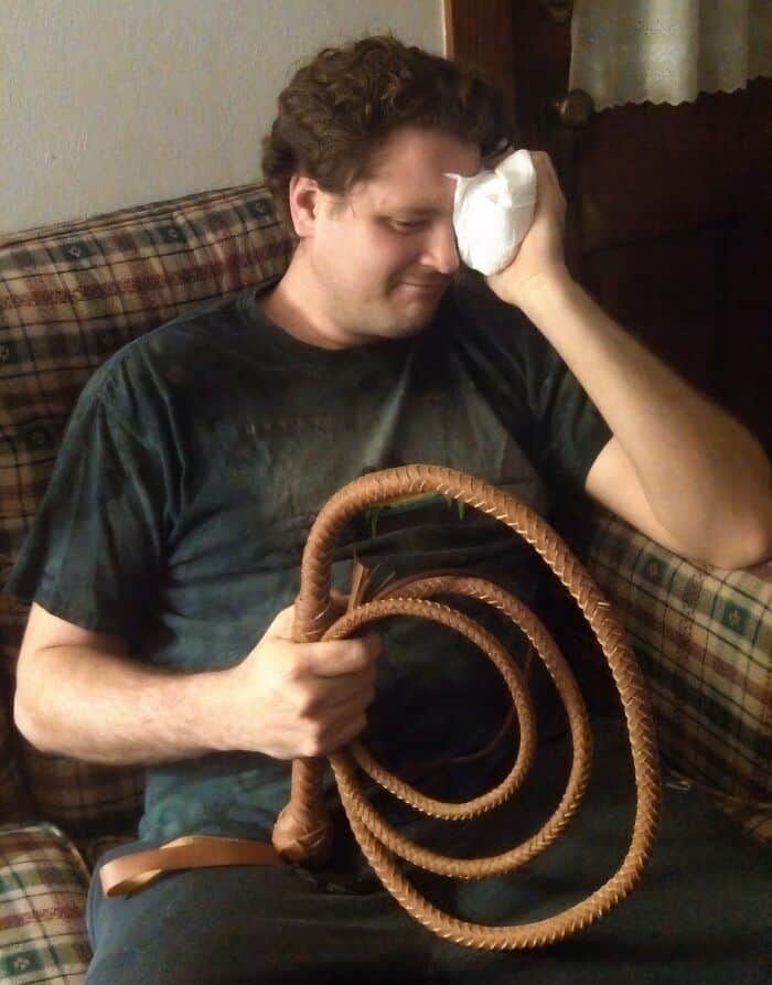 A man holds a leather whip while pressing a cold compress to his injured eye.