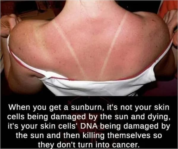 A close-up of a severe sunburn with text explaining that skin cells effectively commit suicide to prevent cancer, a biological random fact about UV damage.
