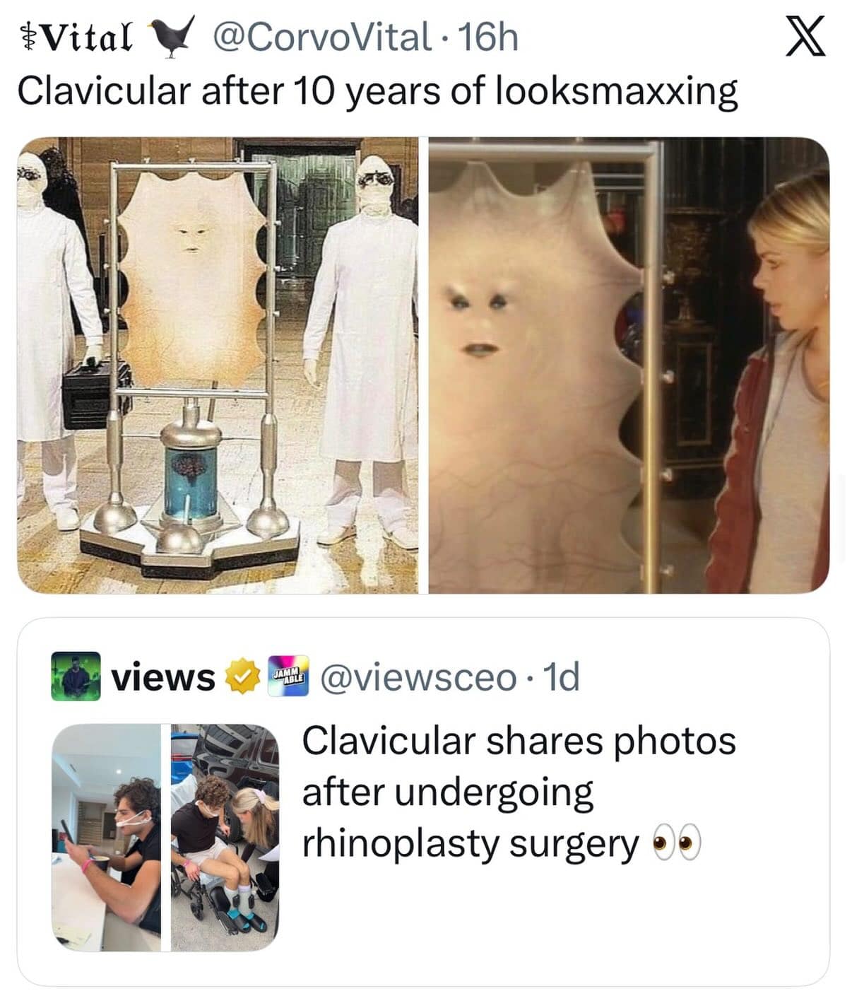 A bizarre sci-fi crossover post from a meme dump comparing an online update about an influencer's rhinoplasty nose surgery to a picture of the flat, stretched-skin character Lady Cassandra from Doctor Who, captioned: "Clavicular after 10 years of looksmaxxing."