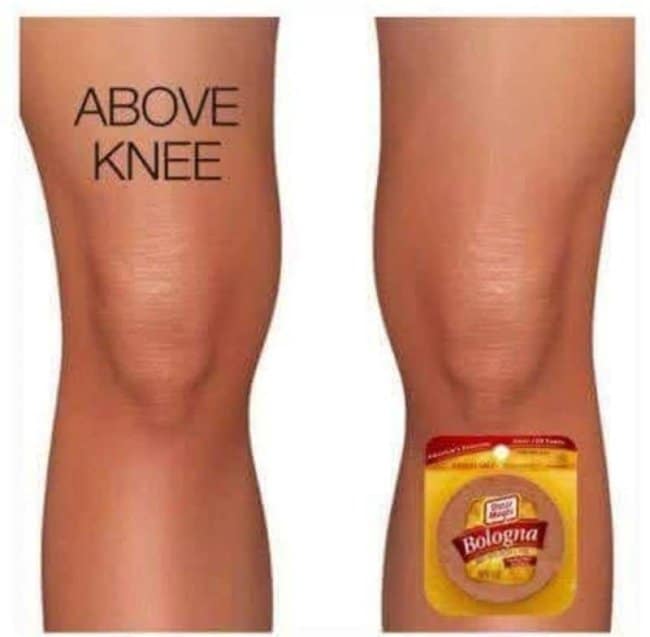 This visually ridiculous punny meme illustrates a phonetic anatomy pun using side-by-side photos of human legs. The left leg features the text "ABOVE KNEE" written high up on the thigh, while the right leg features a package of Oscar Mayer Bologna slapped directly onto the shin to phonetically stand in for the phrase "below knee."