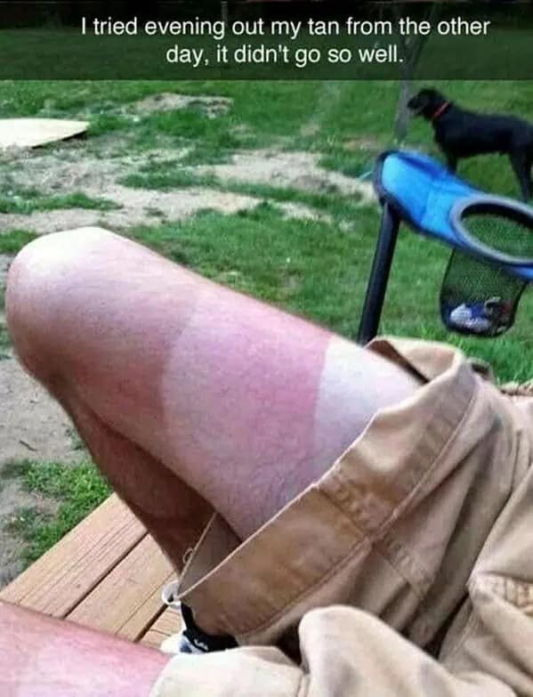 A first-person close-up shot of a leg showing three distinct blocks of varying skin tone from a failed attempt at evening out a sunline, featured in a relatable sunburn meme.