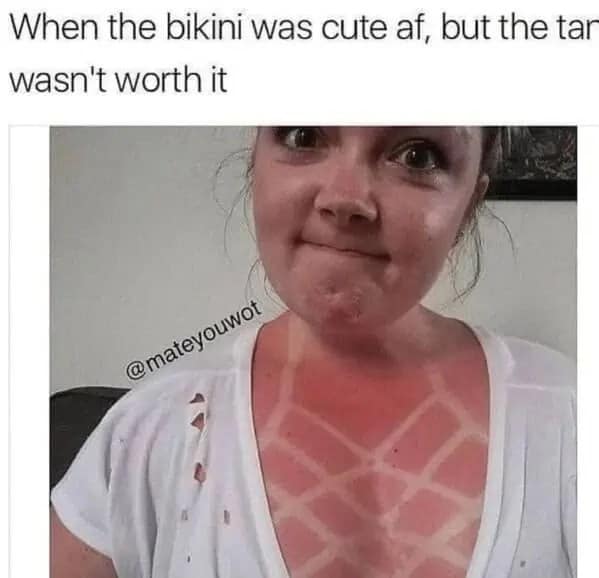 Close-up photo of a woman showing off a complex geometric pattern of white strap marks across her intensely red chest in a summer sunburn meme.
