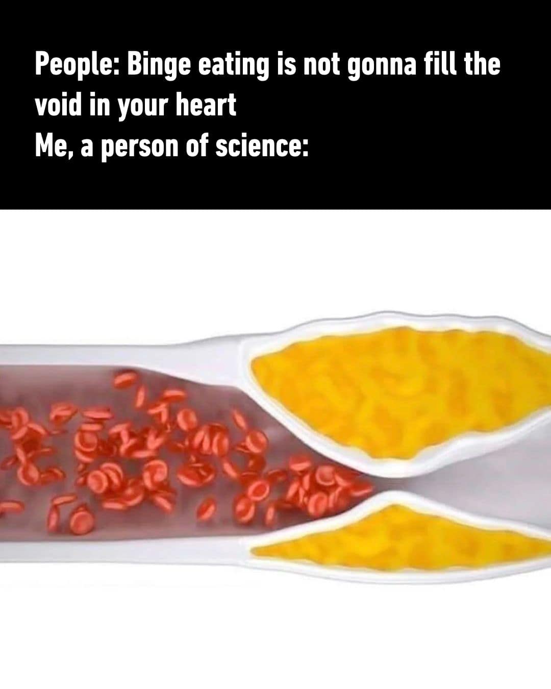 This funny meme uses a medical artery cross-section diagram to joke about filling the void in your heart with yellow mac and cheese.
